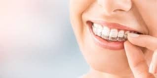 What Are the Benefits of Invisalign Treatment in Houston, Tx?