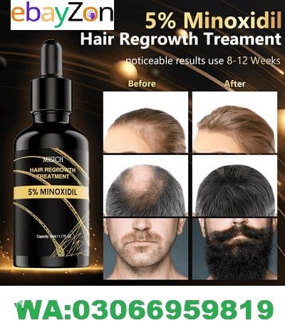 Minoxidil hair growth serum in pakistan price
